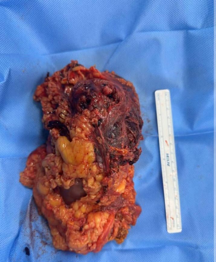 Hospital Andalucía - Hospital 30